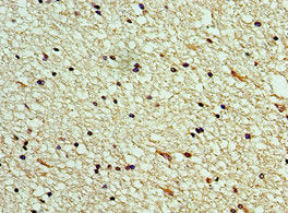 Immunohistochemistry of paraffin-embedded human brain tissue using CLEC11A Antibody at dilution of 1:100Rabbit anti-Human CLEC11A Polyclonal Antibody