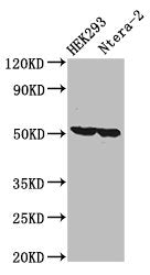 Western Blot | Positive WB detected in: HEK293 whole cell lysate, Ntera-2 whole cell lysate | All lanes: RUVBL1 antibody at 3.2μg/ml | Secondary | Goat polyclonal to rabbit IgG at 1/50000 dilution | Predicted band size: 51, 43 kDa | Observed band size: 51 kDaRabbit anti-Human RUVBL1 Polyclonal Antibody