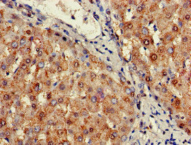 Immunohistochemistry of paraffin-embedded human liver tissue using SIGLEC7 Antibody at dilution of 1:100Rabbit anti-Human SIGLEC7 Polyclonal Antibody