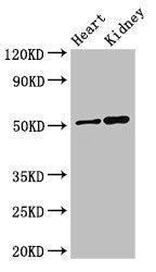 Western Blot | Positive WB detected in: Mouse heart tissue, Mouse kidney tissue | All lanes: SIGLEC7 antibody at 3μg/ml | Secondary | Goat polyclonal to rabbit IgG at 1/50000 dilution | Predicted band size: 52, 42, 17 kDa | Observed band size: 52 kDaRabbit anti-Human SIGLEC7 Polyclonal Antibody