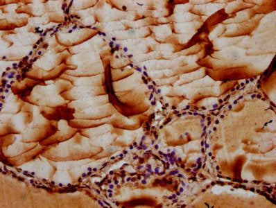 IHC image of MAN2B2 Antibody diluted at 1:100 and staining in paraffin-embedded human thyroid tissue performed on a Leica BondTM system. After dewaxing and hydration, antigen retrieval was mediated by high pressure in a citrate buffer (pH 6.0). Section was blocked with 10% normal goat serum 30min at RT. Then primary antibody (1% BSA) was incubated at 4°C overnight. The primary is detected by a biotinylated secondary antibody and visualized using an HRP conjugated SP system.