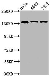 Western Blot | Positive WB detected in: Hela whole cell lysate, A549 whole cell lysate, 293T whole cell lysate | All lanes: MAN2B2 antibody at 1.4μg/ml | Secondary | Goat polyclonal to rabbit IgG at 1/50000 dilution | Predicted band size: 114, 108 kDa | Observed band size: 135 kDa