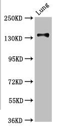 Western Blot | Positive WB detected in: Rat kidney tissue | All lanes: MAN2B2 antibody at 3.4μg/ml | Secondary | Goat polyclonal to rabbit IgG at 1/50000 dilution | Predicted band size: 114, 108 kDa | Observed band size: 114 kDa