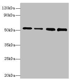 Western blot | All lanes: STK38L antibody at 6μg/ml | Lane 1: A375 whole cell lysate | Lane 2: HepG2 whole cell lysate | Lane 3: A549 whole cell lysate | Lane 4: HCT116 whole cell lysate | Secondary | Goat polyclonal to rabbit IgG at 1/10000 dilution | Predicted band size: 55, 44 kDa | Observed band size: 55 kDaRabbit anti-Human STK38L Polyclonal Antibody
