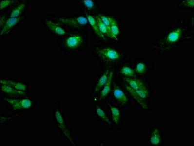 Immunofluorescence staining of Hela cells with PADI2 Antibody at 1:100, counter-stained with DAPI. The cells were fixed in 4% formaldehyde, permeabilized using 0.2% Triton X-100 and blocked in 10% normal Goat Serum. The cells were then incubated with the antibody overnight at 4°C. The secondary antibody was Alexa Fluor 488-congugated AffiniPure Goat Anti-Rabbit IgG(H+L).