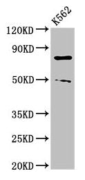 Western Blot  | Positive WB detected in: K562 whole cell lysate  | All lanes: PADI2 antibody at 3μg/ml  | Secondary  | Goat polyclonal to rabbit IgG at 1/50000 dilution  | Predicted band size: 76, 50 kDa  | Observed band size: 76, 50 kDa