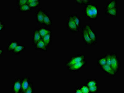 Immunofluorescent analysis of HepG2 cells using WNK2 Antibody at dilution of 1:100 and Alexa Fluor 488-congugated AffiniPure Goat Anti-Rabbit IgG(H+L)