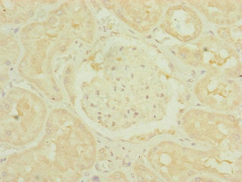 Immunohistochemistry of paraffin-embedded human kidney tissue using the antibody at dilution of 1:100Rabbit anti-Human TIMM10B Polyclonal Antibody