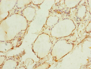 Immunohistochemistry of paraffin-embedded human thyroid tissue using TIMM10B Antibody at dilution of 1:100Rabbit anti-Human TIMM10B Polyclonal Antibody
