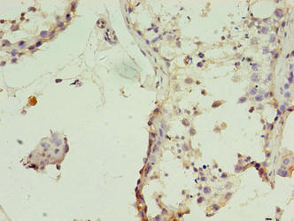 Immunohistochemistry of paraffin-embedded human testis tissue using TIMM10B Antibody at dilution of 1:100Rabbit anti-Human TIMM10B Polyclonal Antibody