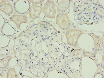 Immunohistochemistry of paraffin-embedded human kidney tissue using TIMM10B Antibody at dilution of 1:100Rabbit anti-Human TIMM10B Polyclonal Antibody