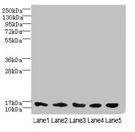 Western blot | All lanes: TIMM10B antibody at 4μg/ml | Lane 1: Hela whole cell lysate | Lane 2: 293T whole cell lysate | Lane 3: HepG2 whole cell lysate | Lane 4: K562 whole cell lysate | Lane 5: Mouse heart tissue | Secondary | Goat polyclonal to rabbit IgG at 1/10000 dilution | Predicted band size: 12 kDa | Observed band size: 12 kDaRabbit anti-Human TIMM10B Polyclonal Antibody