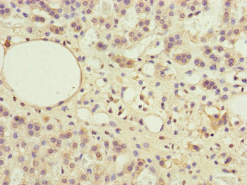 Immunohistochemistry of paraffin-embedded human adrenal gland tissue using PPP2R3B Antibody at dilution of 1:100Rabbit anti-Human PPP2R3B Polyclonal Antibody