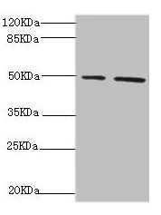 Western blot  | All lanes: NFS1 antibody at 6.21µg/ml  | Lane 1: HepG2 whole cell lysate  | Lane 2: Hela whole cell lysate  | Secondary  | Goat polyclonal to rabbit IgG at 1/10000 dilution  | Predicted band size: 51, 45 kDa  | Observed band size: 51 kDaRabbit anti-Human NFS1 Polyclonal Antibody