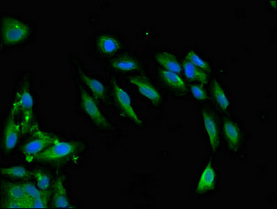 Immunofluorescent analysis of Hela cells using SNCAIP Antibody at dilution of 1:100 and Alexa Fluor 488-congugated AffiniPure Goat Anti-Rabbit IgG(H+L)Rabbit anti-Human SNCAIP Polyclonal Antibody