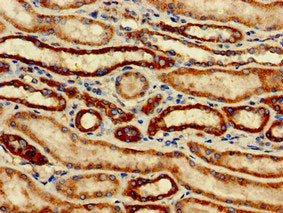 Immunohistochemistry of paraffin-embedded human kidney tissue using the antibody at dilution of 1:100Rabbit anti-Human SNCAIP Polyclonal Antibody