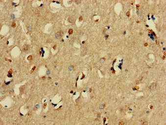 Immunohistochemistry of paraffin-embedded human brain tissue using SNCAIP Antibody at dilution of 1:100Rabbit anti-Human SNCAIP Polyclonal Antibody