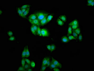 Immunofluorescence staining of HepG2 cells with WASF2 Antibody at 1:166, counter-stained with DAPI. The cells were fixed in 4% formaldehyde, permeabilized using 0.2% Triton X-100 and blocked in 10% normal Goat Serum. The cells were then incubated with the antibody overnight at 4°C. The secondary antibody was Alexa Fluor 488-congugated AffiniPure Goat Anti-Rabbit IgG(H+L).Rabbit anti-Human WASF2 Polyclonal Antibody