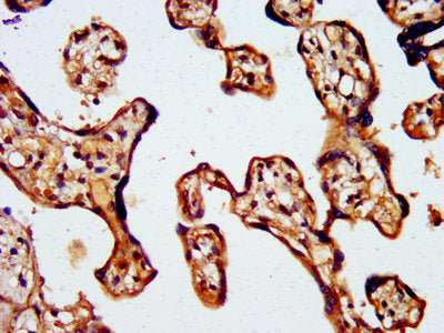 IHC image of the antibody diluted at 1:500 and staining in paraffin-embedded human placenta tissue performed on a Leica BondTM system. After dewaxing and hydration, antigen retrieval was mediated by high pressure in a citrate buffer (pH 6.0). Section was blocked with 10% normal goat serum 30min at RT. Then primary antibody (1% BSA) was incubated at 4°C overnight. The primary is detected by a biotinylated secondary antibody and visualized using an HRP conjugated SP system.Rabbit anti-Human WASF2 Polyclonal Antibody