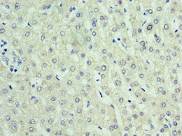 Immunohistochemistry of paraffin-embedded human liver tissue using RTRAF Antibody at dilution of 1:100Rabbit anti-Human RTRAF Polyclonal Antibody
