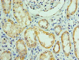 Immunohistochemistry of paraffin-embedded human kidney tissue using RTRAF Antibody at dilution of 1:100Rabbit anti-Human RTRAF Polyclonal Antibody