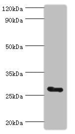 Western blot | All lanes: C14orf166 antibody at 6μg/ml + Mouse lung tissue | Secondary | Goat polyclonal to rabbit IgG at 1/10000 dilution | Predicted band size: 28 kDa | Observed band size: 28 kDaRabbit anti-Human RTRAF Polyclonal Antibody