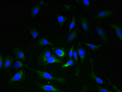 Immunofluorescent analysis of Hela cells using ERGIC3 Antibody at dilution of 1:100 and Alexa Fluor 488-congugated AffiniPure Goat Anti-Rabbit IgG(H+L)Rabbit anti-Human ERGIC3 Polyclonal Antibody