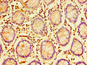 Immunohistochemistry of paraffin-embedded human colon tissue using ERGIC3 Antibody at dilution of 1:100Rabbit anti-Human ERGIC3 Polyclonal Antibody