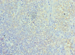Immunohistochemistry of paraffin-embedded human tonsil tissue using ASF1A Antibody at dilution of 1:100Rabbit anti-Human ASF1A Polyclonal Antibody