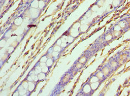 Immunohistochemistry of paraffin-embedded human colon tissue using ASF1A Antibody at dilution of 1:100Rabbit anti-Human ASF1A Polyclonal Antibody