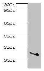Western blot  | All lanes: ASF1A antibody at 2µg/ml + Jurkat whole cell lysate  | Secondary  | Goat polyclonal to rabbit IgG at 1/10000 dilution  | Predicted band size: 23 kDa  | Observed band size: 23 kDaRabbit anti-Human ASF1A Polyclonal Antibody