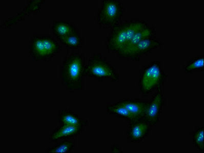 Immunofluorescent analysis of Hela cells using the antibody at dilution of 1:100 and Alexa Fluor 488-congugated AffiniPure Goat Anti-Rabbit IgG(H+L)