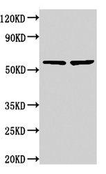 Western Blot  | Positive WB detected in: 293 whole cell lysate, 293T whole cell lysate  | All lanes: NOP58 antibody at 3.75μg/ml  | Secondary  | Goat polyclonal to rabbit IgG at 1/50000 dilution  | Predicted band size: 60 kDa  | Observed band size: 60 kDa