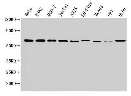 Western Blot  | Positive WB detected in: Hela whole cell lysate, K562 whole cell lysate, MCF-7 whole cell lysate, Jurkat whole cell lysate, A375 whole cell lysate, SH-SY5Y whole cell lysate, HepG2 whole cell lysate, U87 whole cell lysate, HL60 whole cell lysate  | All lanes: NOP58 antibody at 1:2000  | Secondary  | Goat polyclonal to rabbit IgG at 1/50000 dilution  | Predicted band size: 60 kDa  | Observed band size: 60 kDa