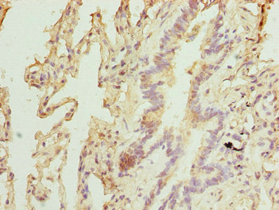 Immunohistochemistry of paraffin-embedded human lung tissue using TPRKB Antibody at dilution of 1:100Rabbit anti-Human TPRKB Polyclonal Antibody