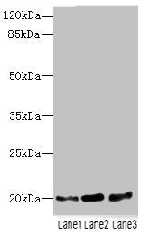 Western blot | All lanes: TPRKB antibody at 5μg/ml | Lane 1: A549 whole cell lysate | Lane 2: Jurkat whole cell lysate | Lane 3: MCF-7 whole cell lysate | Secondary | Goat polyclonal to rabbit IgG at 1/10000 dilution | Predicted band size: 20, 17, 24 kDa | Observed band size: 20 kDaRabbit anti-Human TPRKB Polyclonal Antibody