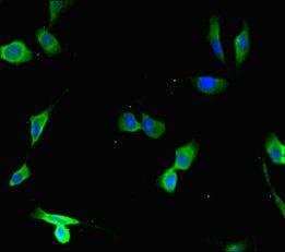 Immunofluorescent analysis of Hela cells using DCAF1 Antibody at dilution of 1:100 and Alexa Fluor 488-congugated AffiniPure Goat Anti-Rabbit IgG(H+L)