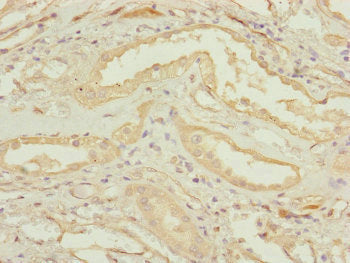 Immunohistochemistry of paraffin-embedded human kidney tissue using CEP83 Antibody at dilution of 1:100Rabbit anti-Human CEP83 Polyclonal Antibody
