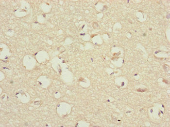 Immunohistochemistry of paraffin-embedded human brain tissue using CEP83 Antibody at dilution of 1:100Rabbit anti-Human CEP83 Polyclonal Antibody