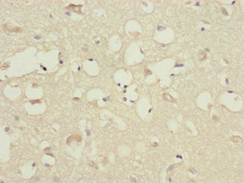 Immunohistochemistry of paraffin-embedded human brain tissue using CEP83 Antibody at dilution of 1:100Rabbit anti-Human CEP83 Polyclonal Antibody