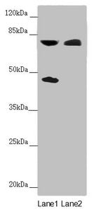 Western blot | All lanes: CEP83 antibody at 2.27 μg/ml | Lane 1: Mouse liver tissue | Lane 2: COLO205 whole cell lysate | Secondary | Goat polyclonal to rabbit IgG at 1/10000 dilution | Predicted band size: 83, 68 kDa | Observed band size: 83, 45 kDaRabbit anti-Human CEP83 Polyclonal Antibody