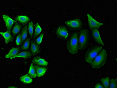 Immunofluorescent analysis of A549 cells using BACE2 Antibody at dilution of 1:100 and Alexa Fluor 488-congugated AffiniPure Goat Anti-Rabbit IgG(H+L)