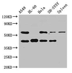 Western Blot | Positive WB detected in: A549 whole cell lysate, HL60 whole cell lysate, Hela whole cell lysate, SH-SY5Y whole cell lysate, Rat spleen tissue | All lanes: BACE2 antibody at 2.5μg/ml | Secondary | Goat polyclonal to rabbit IgG at 1/50000 dilution | Predicted band size: 57, 51, 43, 39, 47 kDa | Observed band size: 57, 43 kDa