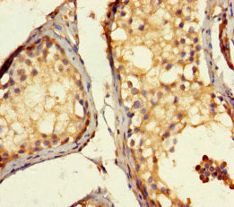 Immunohistochemistry of paraffin-embedded human testis tissue using ACTL7A Antibody at dilution of 1:100