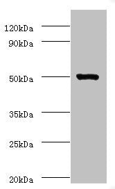 Western blot  | All lanes: ACTL7A antibody at 2μg/ml + Mouse liver tissue  | Secondary  | Goat polyclonal to rabbit IgG at 1/10000 dilution  | Predicted band size: 49 kDa  | Observed band size: 49 kDa