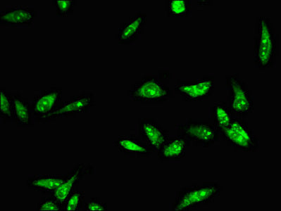Immunofluorescent analysis of Hela cells using RAD54B Antibody at dilution of 1:100 and Alexa Fluor 488-congugated AffiniPure Goat Anti-Rabbit IgG(H+L)Rabbit anti-Human RAD54B Polyclonal Antibody