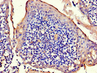 Immunohistochemistry of paraffin-embedded human tonsil tissue using the antibody at dilution of 1:100Rabbit anti-Human RAD54B Polyclonal Antibody