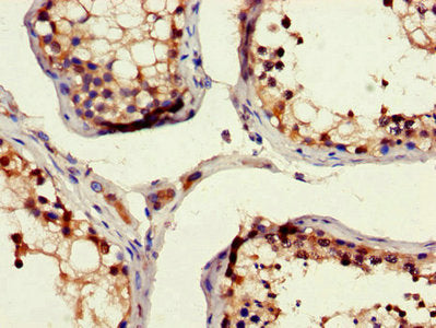 Immunohistochemistry of paraffin-embedded human testis tissue using RAD54B Antibody at dilution of 1:100Rabbit anti-Human RAD54B Polyclonal Antibody