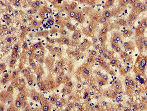 Immunohistochemistry of paraffin-embedded human liver tissue using SEC23IP Antibody at dilution of 1:100Rabbit anti-Human SEC23IP Polyclonal Antibody