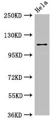 Western Blot  | Positive WB detected in: Hela whole cell lysate  | All lanes: SEC23IP antibody at 2.7µg/ml  | Secondary  | Goat polyclonal to rabbit IgG at 1/50000 dilution  | Predicted band size: 112, 103 kDa  | Observed band size: 112 kDaRabbit anti-Human SEC23IP Polyclonal Antibody